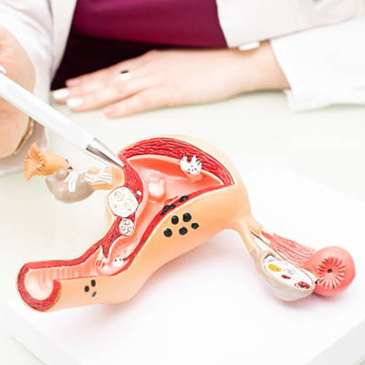 Gynecology
